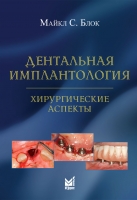 Дентальная имплантология: хирургические аспекты. / Блок М.