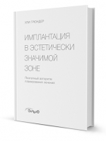 Имплантация в эстетически значимой зоне. Поэтапный алгоритм планирования лечения. / Ули Грюндер