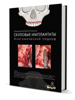 Скуловые имплантаты. Анатомический подход. / Под редакцией Карлоса Апарисио