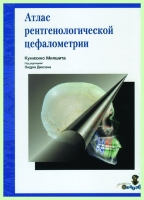 Атлас рентгенологической цефалометрии / К. Мияшита