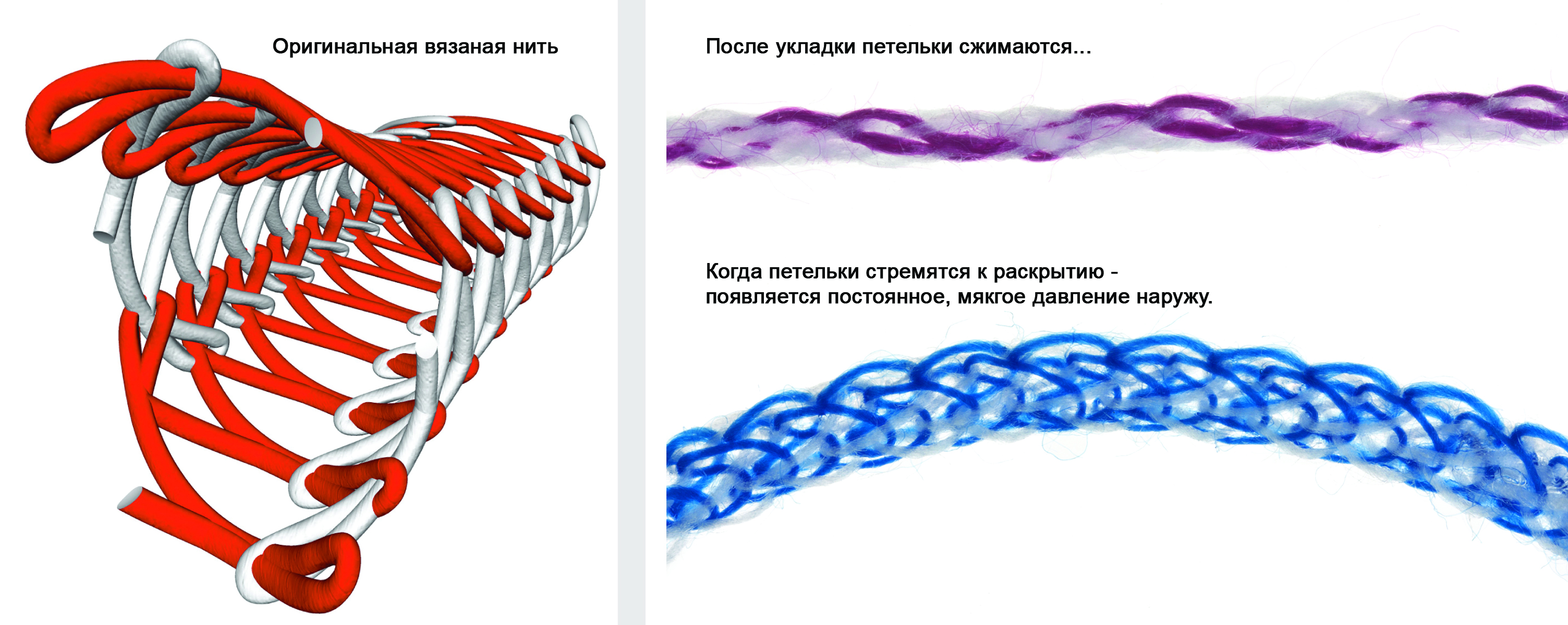 UltraPak - ретракционная нить размер 1