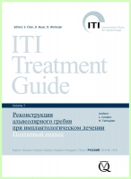 Реконструкция альвеолярного гребня при имплантологическом лечении. Поэтапный подход. (ITI том 7).