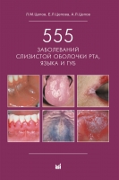 555 заболеваний слизистой оболочки рта, языка и губ. / Цепов Л.М., Цепова Е.Л., Цепов А.Л.