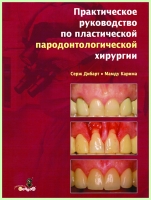 Практическое руководство по пластической пародонтологической хирургии  / С. Дибарт